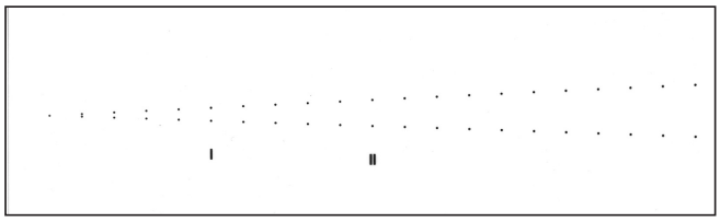 S25 Foepple Dot Vibration Test Pattern